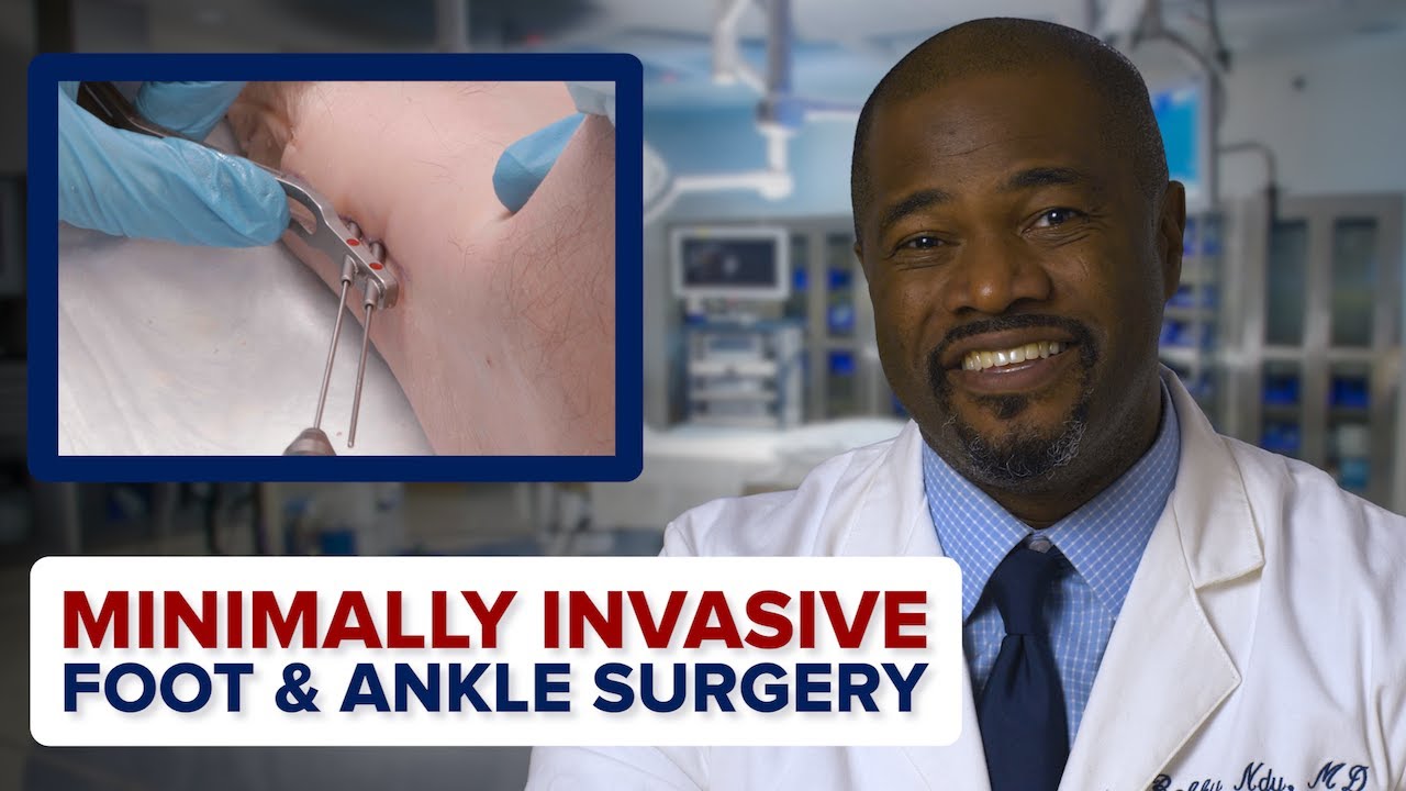 Minimally Invasive Foot & Ankle Surgery | Penn Orthopaedics - YouTube