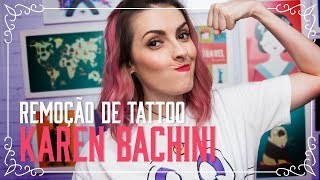 Karen Bachini - Remoção de Tatuagem no Tattoo You