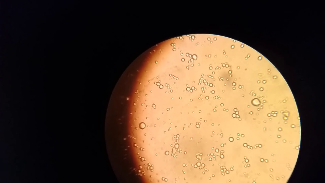 Yogurt Under Microscope At William Fellows Blog