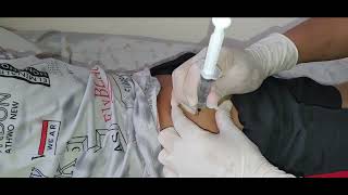 intramuscular injections