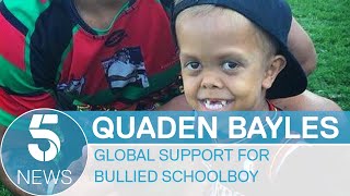 Quaden Bayles: Celebrities support bullied schoolboy with dwarfism | 5 News