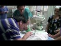 chilean surgeons separate conjoined twins