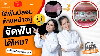 ใส่ฟันปลอมอยู่ จัดฟันได้ไหม? จะเห็นว่าฟันหลอหรือเปล่า? |จัดฟันที่แท้ FunFriends เพื่อนกันฟันดี|