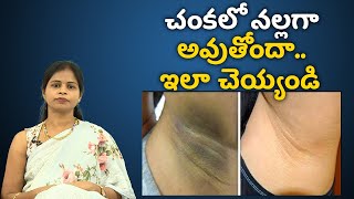 Dark Underarms Causes Treatment and Prevention | చంకలో నల్లగా అవుతోందా.. ఇలా చెయ్యండి Samayam Telugu