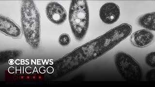 2 sickened in Legionnaires' outbreak linked to Chicago-area nursing facility