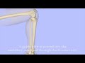 intramedullary nailing of the tibia