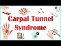 Carpal Tunnel Syndrome :- Causes, Clinical Presentation, Pathophysiology, Diagnosis & Treatment