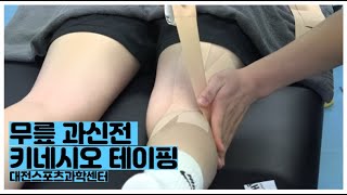 [테이핑] 무릎 과신전 탄력 스포츠테이핑 (대전스포츠과학센터)