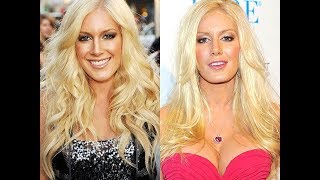 Heidi Montag and Regretful Plastic Surgery
