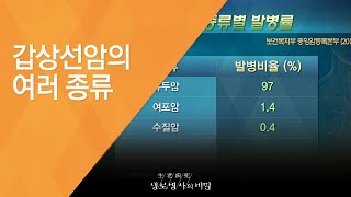 갑상선암의 여러 종류 - (20140402_498회 방송)_착한 암의 두 얼굴, 갑상선