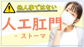 【大腸がんによるリスク！？】人工肛門（ストーマ）を知っていますか？手術の流れと患者さんの気持ち。看護師の私が思うこと