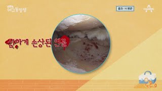 ＂딱＂ 무릎에서 이런 소리가 난다면 관절염을 주의하세요! | 산전수전 여고동창생 66 회