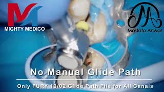 FURY L60 Rotary System | Obliterated Curved Root Canals | Lower Molar | Mighty Medico | RCT | Endo