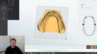 Validation of the scanner accuracy CAD evaluation of special ball models