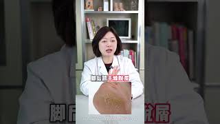 这几个特征的女性，一看就有传染病，擦亮眼睛丝状疣 hpv 两性 女生必看 抖出健康知识宝藏