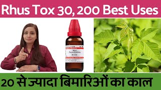 Rhus tox 200, Rhus tox 30 homeopathic medicine uses | 20 से ज्यादा बिमारियों का