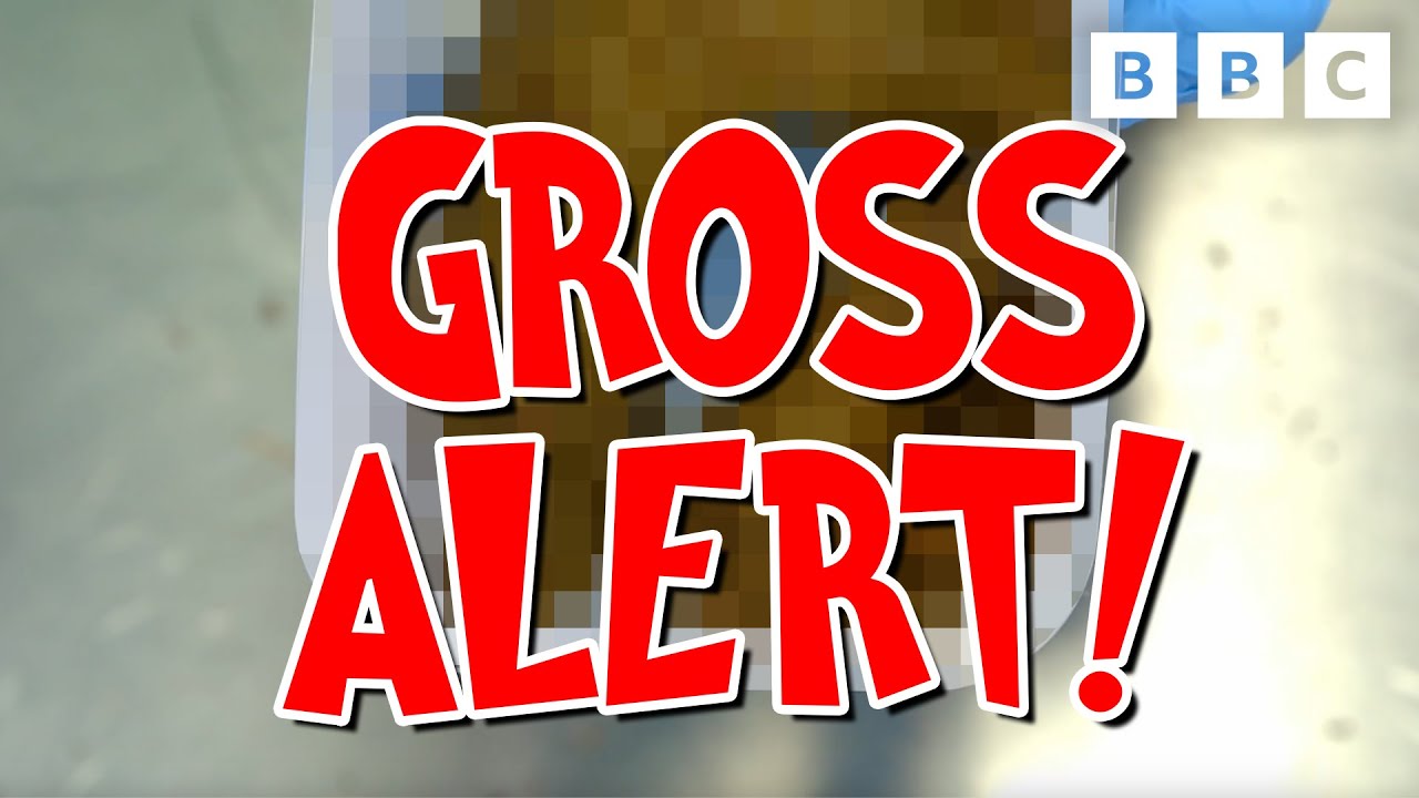 Operation Ouch! Series 11 | Ultimate GROSS ALERT! | CBBC - YouTube