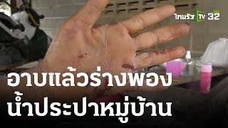 อาบแล้วร่างพองน้ำประปาหมู่บ้าน | 23-05-66 | ข่าวเย็นไทยรัฐ