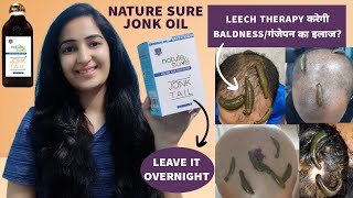 Nature Sure Jonk Oil Review | Leech Therapy For Treating Baldness | Jonk Therapy For Hair Regrowth