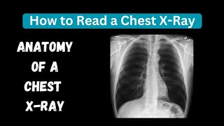 NORMAL CHEST X-RAY EXPLAINED | IN 3 MINUTES
