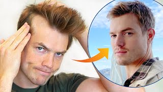 How I Stopped My Receding Hairline (Men's Hair Loss Guide)