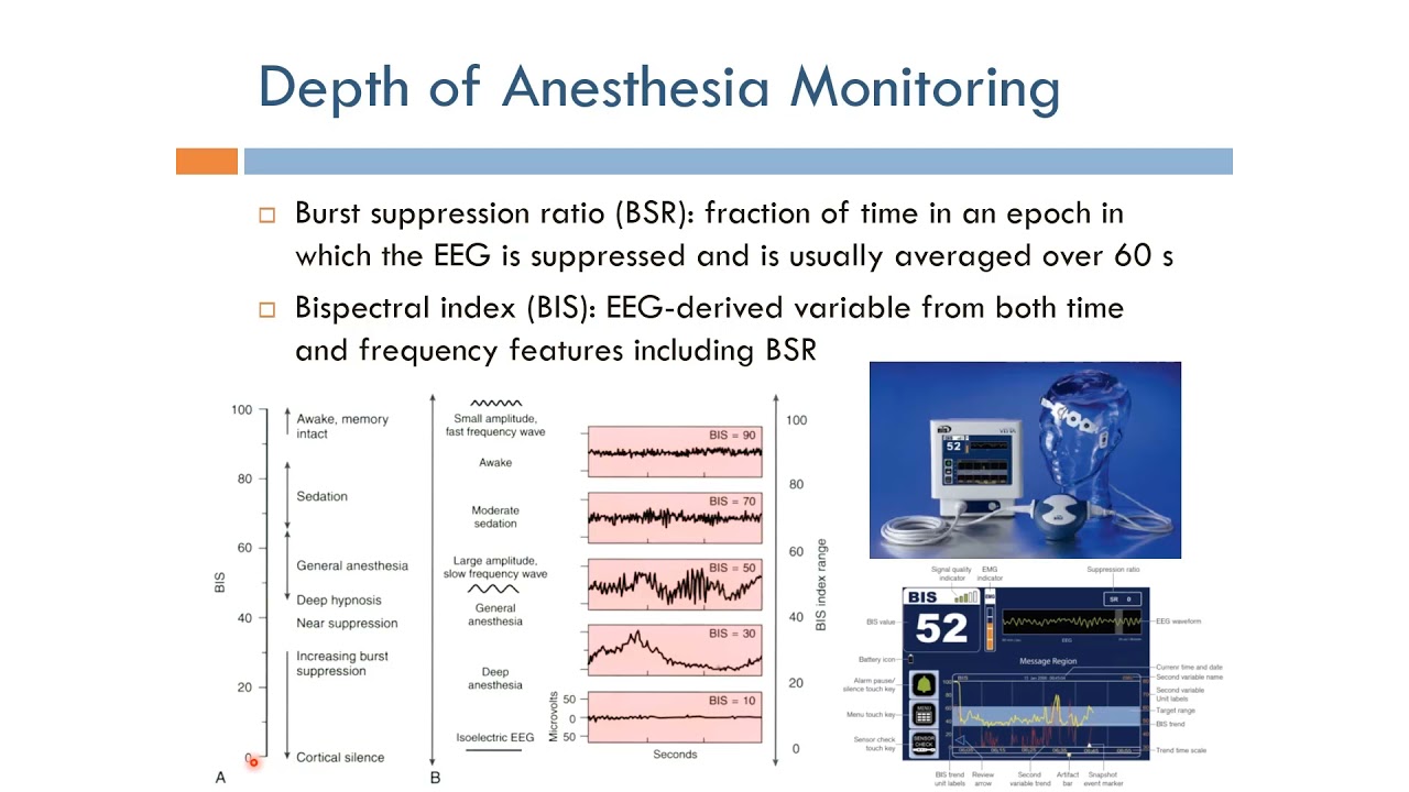 Anesthesia: Depth Of Anesthesia Monitoring (English Narration) - YouTube