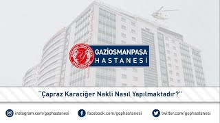 Çapraz Karaciğer Nakli Nasıl Yapılmaktadır?