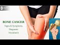 Bone Cancer: Types, Causes, Symptoms, Diagnosis | Bone Marrow-Dr. Mangesh P Kamath | Doctors' Circle