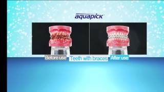 Aquapick Oral Irrigator AQ 300  Before \u0026 After