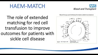 The role of extended matching for red cell blood transfusion to help sickle cell disease patients