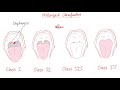 airway management tracheal intubation anesthesiology series