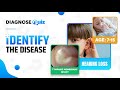 Can you Identify this Disease? | Diagnosequiz #9