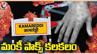 Kamareddy Reports First Case Of Monkeypox | Telangana | V6 News