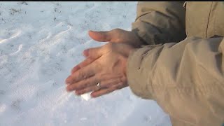 Mercy Health's Dr. Denise Bobovnyk breaks down the basics of frostbite