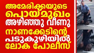 അമേരിക്കയുടെ പൊയ്മുഖം അഴിഞ്ഞു വീണു.  നാണക്കേടിന്റെ പടുകുഴിയിൽ ലോക പോലീസ്.