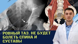 Быстро убрать перекос таза и боль в пояснице. чтоб закрепить эффект используйте