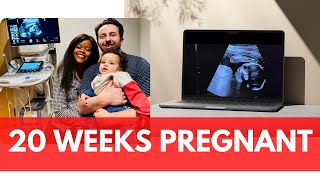 20 week ultrasound I pregnancy vlog