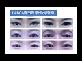 상안검수술 abc성형외과가 알려주는 중년눈성형 모르면 손해다