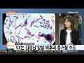 뉴스초점 김정남 암살 유력 독극물 vx 어떤 물질 연합뉴스tv yonhapnewstv