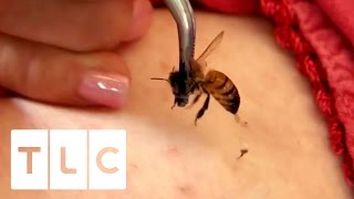 15 Bee Stings A Day | My Strange Addiction
