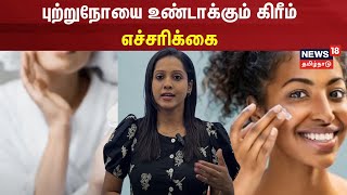 புற்றுநோயை உண்டாக்கும் கிரீம் - எச்சரிக்கை | Lifestyle | Health | Cancer | N18V