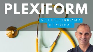 Removing Plexiform Neurofibroma | Explained by NF Surgeon