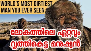 ലോകത്തിലെ ഏറ്റവും വൃത്തികെട്ട മനുഷ്യൻ 😱😱 | WORLD'S MOST DIRTIEST MAN YOU EVER SEEN| Q SMART| #shorts