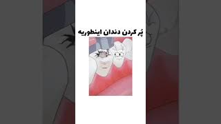 پر کردن دندون اینطوریه😬😰