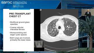 SSMC - Abu Dhabi Surgical Pathology Journal Club: Pulmonary Pathology Slide Seminar