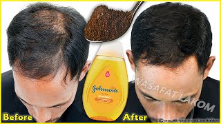 Put these ingredients in your shampoo, 🌱 it accelerates hair growth and treats baldness