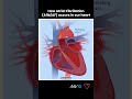 how atrial fibrillation afib af occurs in the heart