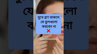 মুখে ব্রণ থাকলে যে ভুল গুলো কখনোই করবেন না ❌ #youtubeshorts #shorts #pimple