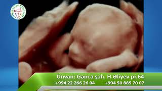 Fetal MRT nədir və nə zaman ehtiyac duyulur - Fetal radioloq Elnarə Sərdarova