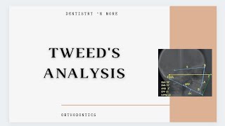 TWEED'S ANALYSIS